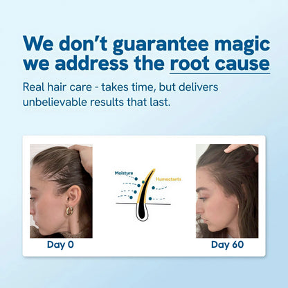 HerVitalz™ - Hair Growth Roll-On Serum